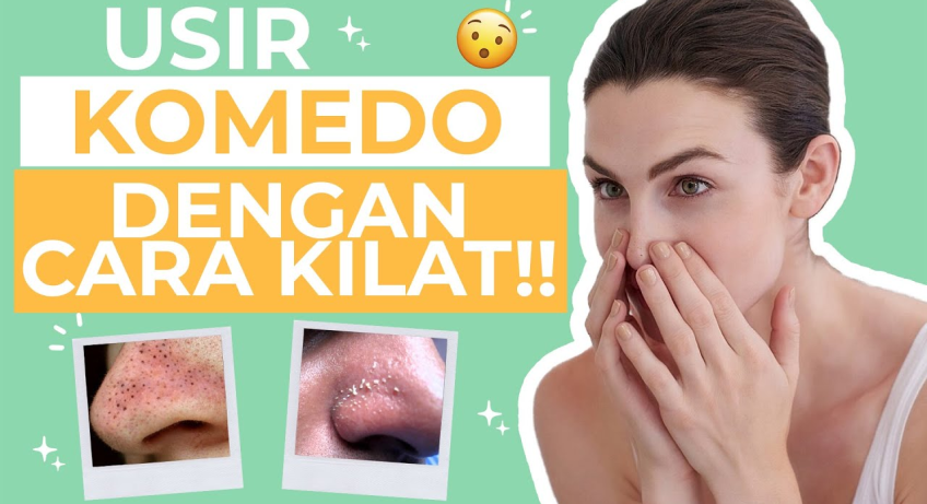 Tips Cegah Komedo